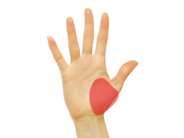 腱鞘炎の手のひら