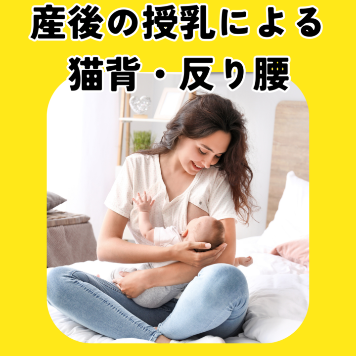 産後の授乳による猫背・反り腰の画像