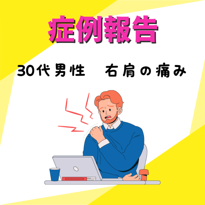 デスクワークによる慢性的な肩こり・姿勢が症状の30代男性の画像