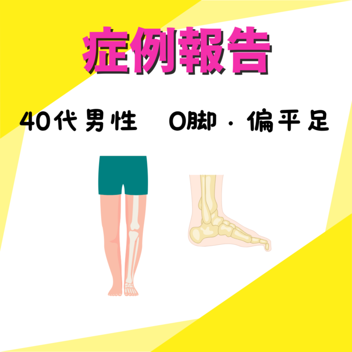 40代男性 偏平足やO脚、足の悩みの症例報告の画像