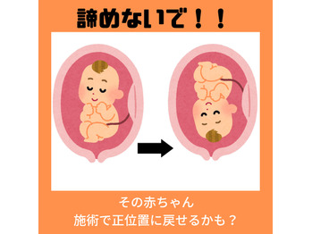 逆子と診断された方、あきらめないで！