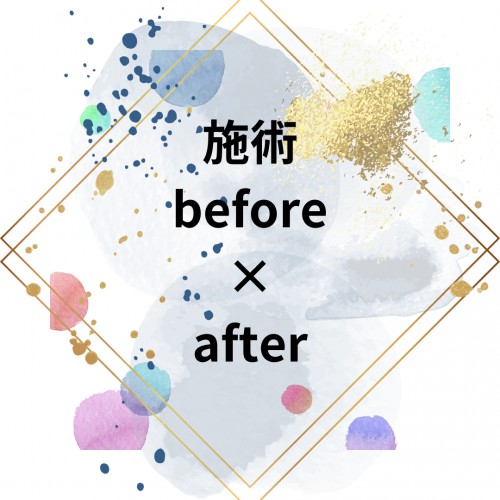 施術Befor×Afterの画像